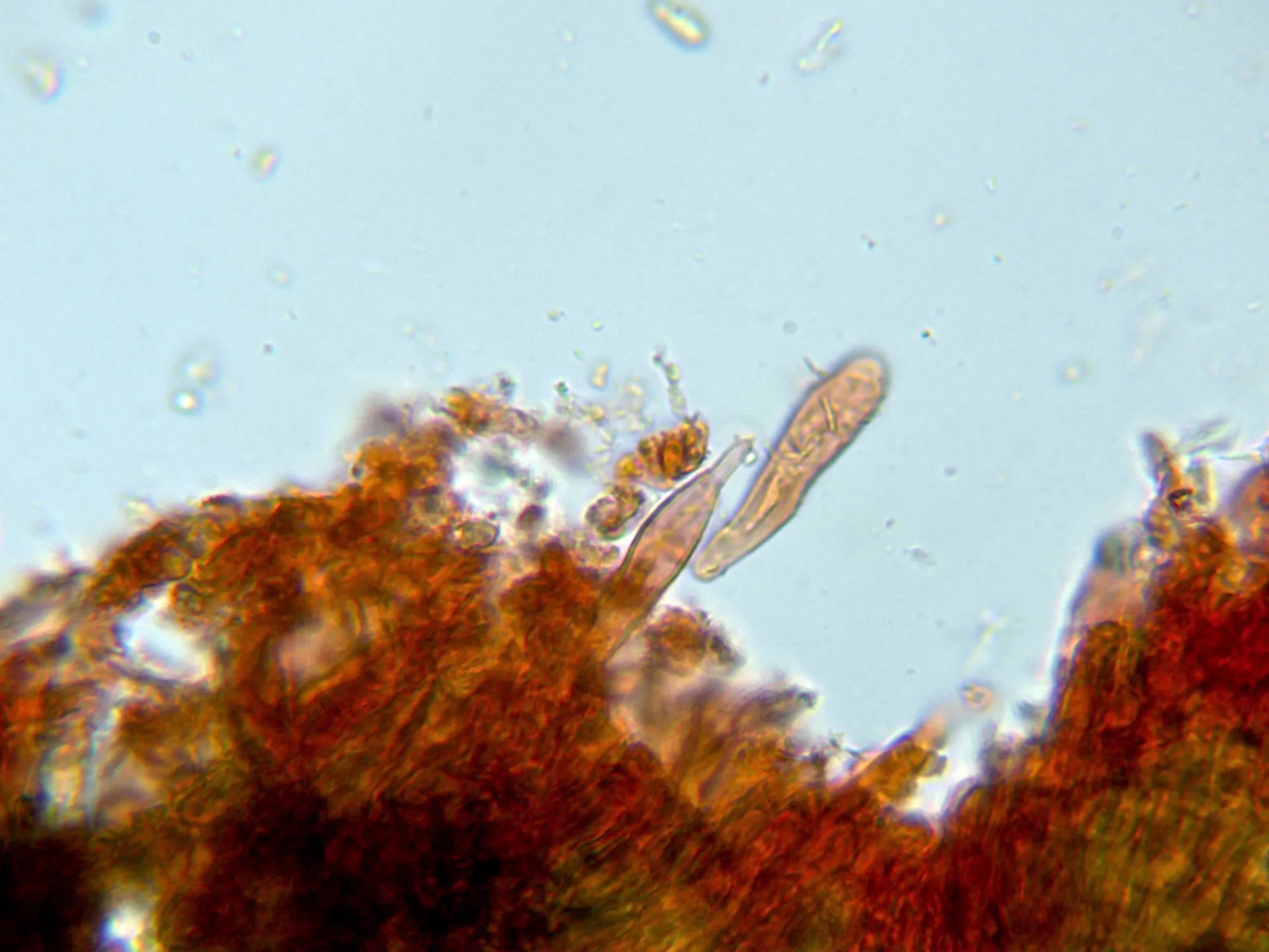 Microscopía de Peniophora limitata - 10 - Cistidio-002